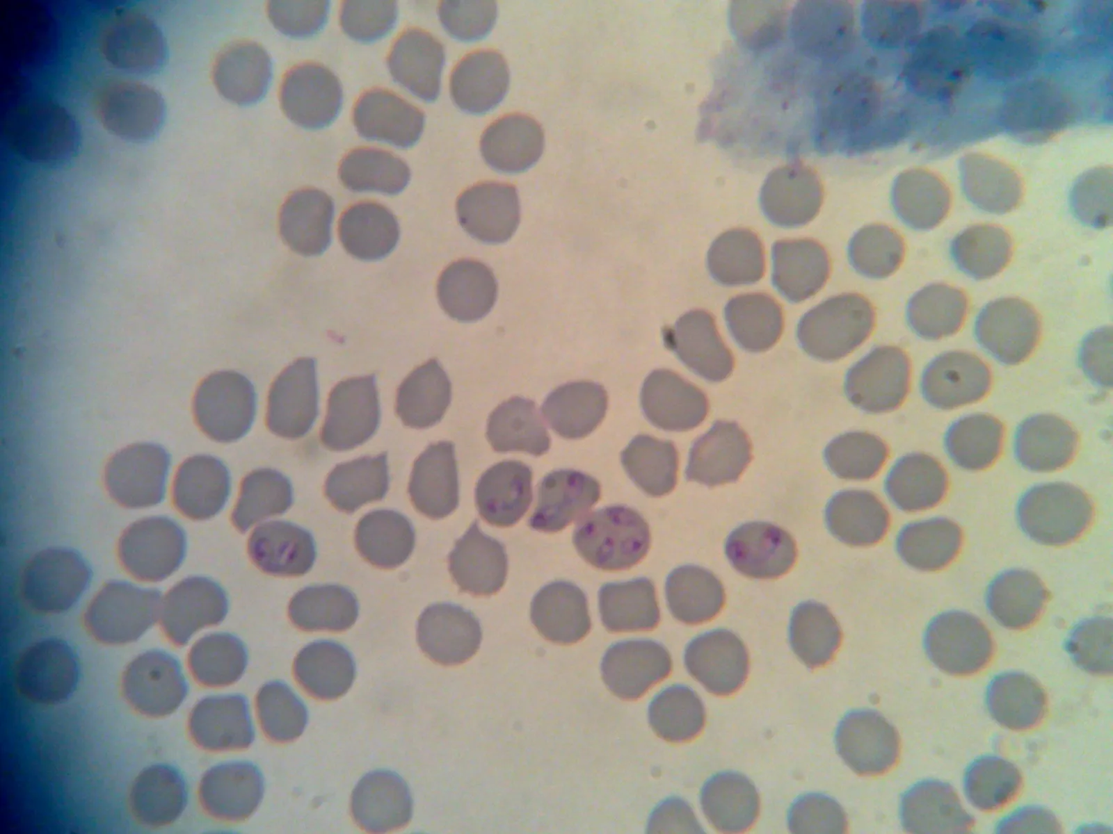 Erytrocyty z merozoitami Babesia canis – preparat 1
