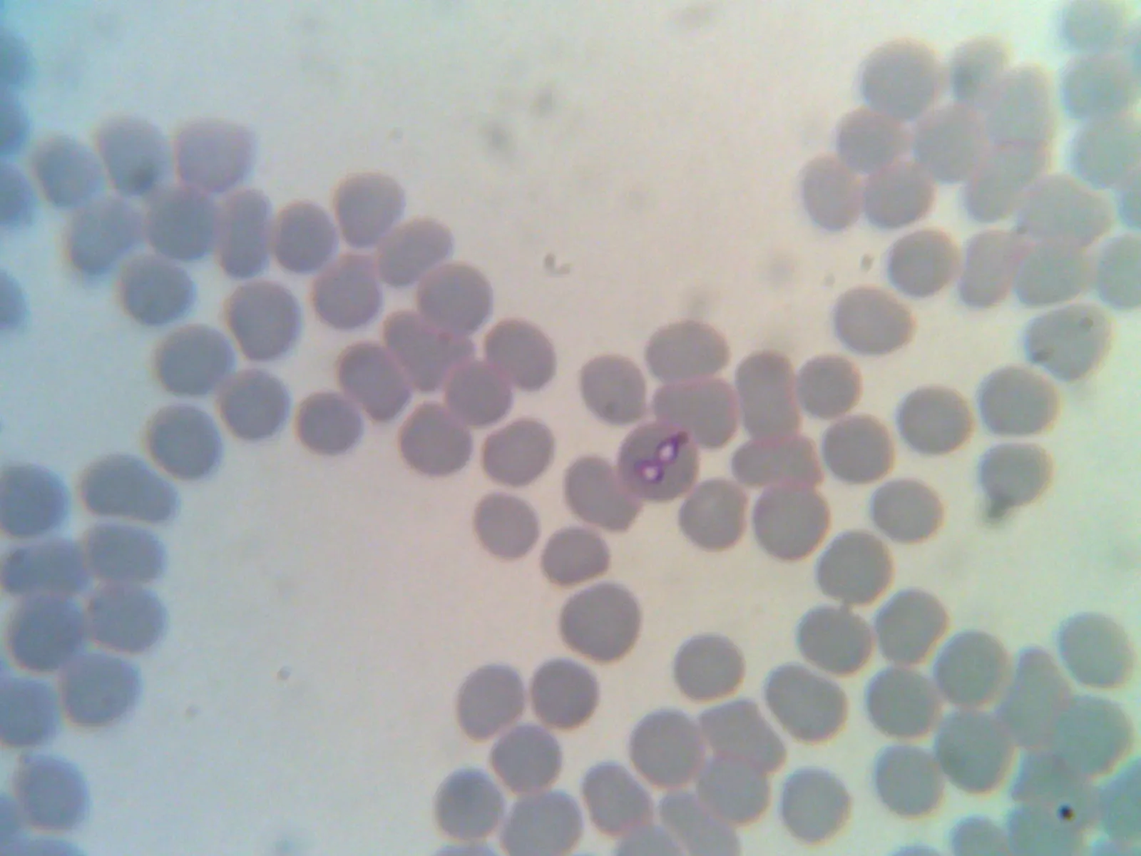Erytrocyty z merozoitami Babesia canis – preparat 2