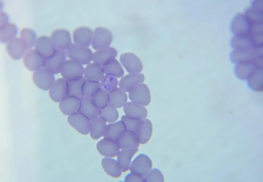 Erytrocyty z merozoitami Babesia canis – preparat 3